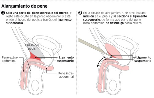 pene