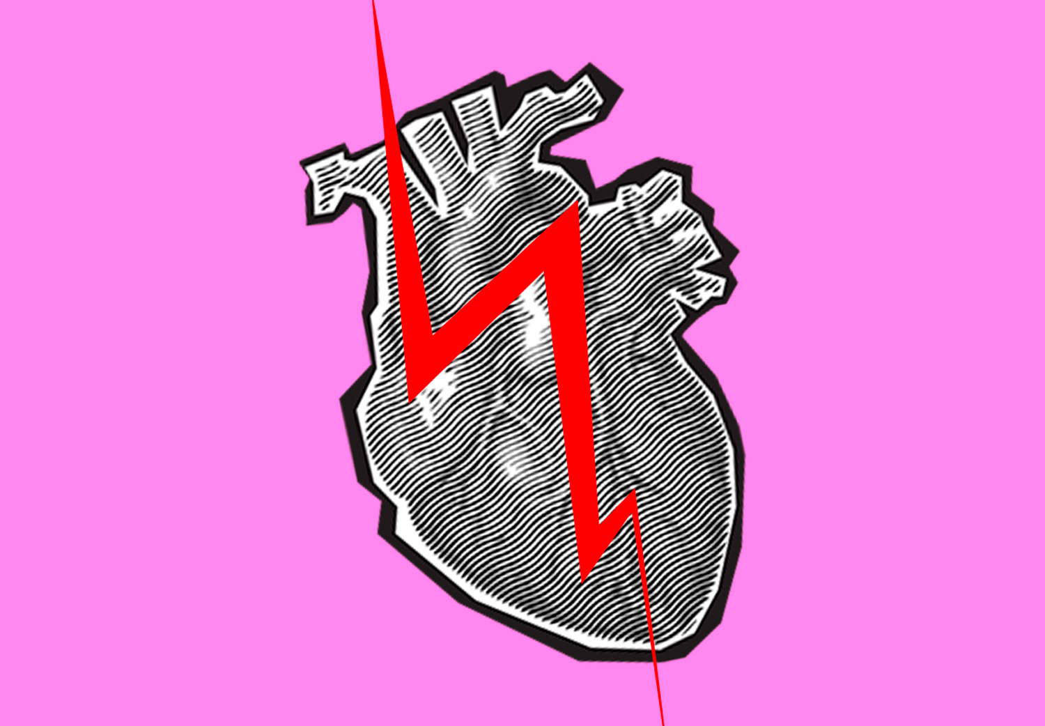corazón-roto-Síndrome-de-TakoTsubo