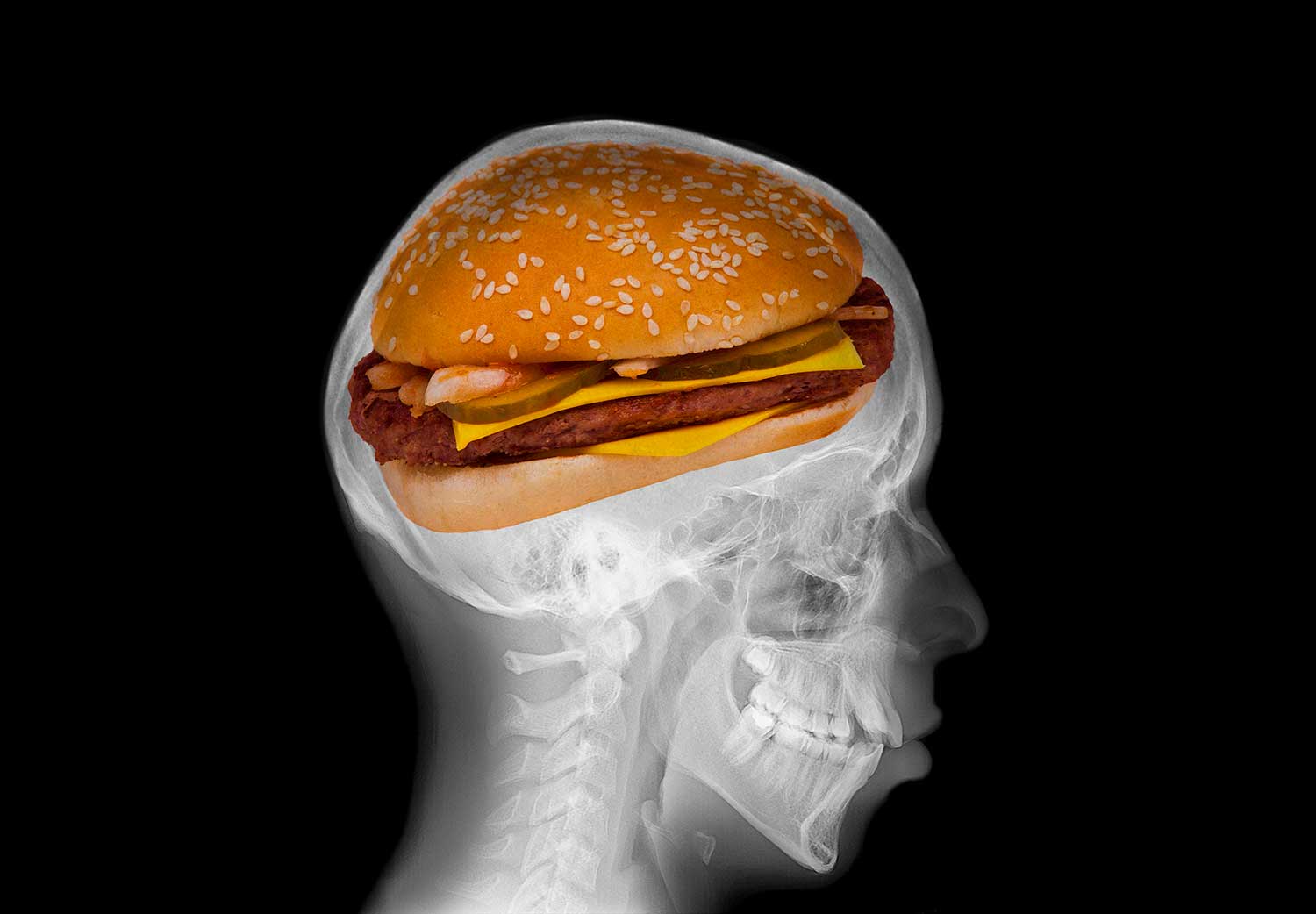 comida chatarra cambia tu cerebro