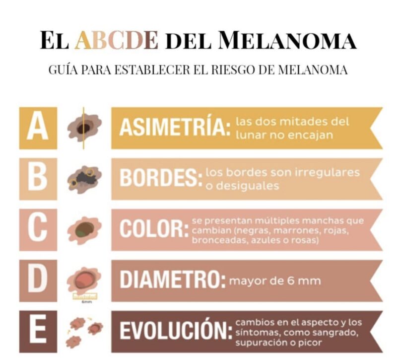 abc melanoma