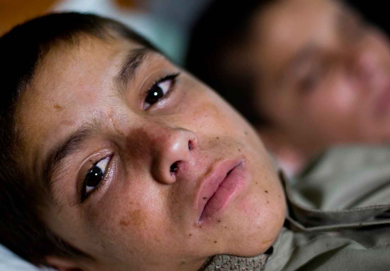 niños-solares-niños-catatonicos