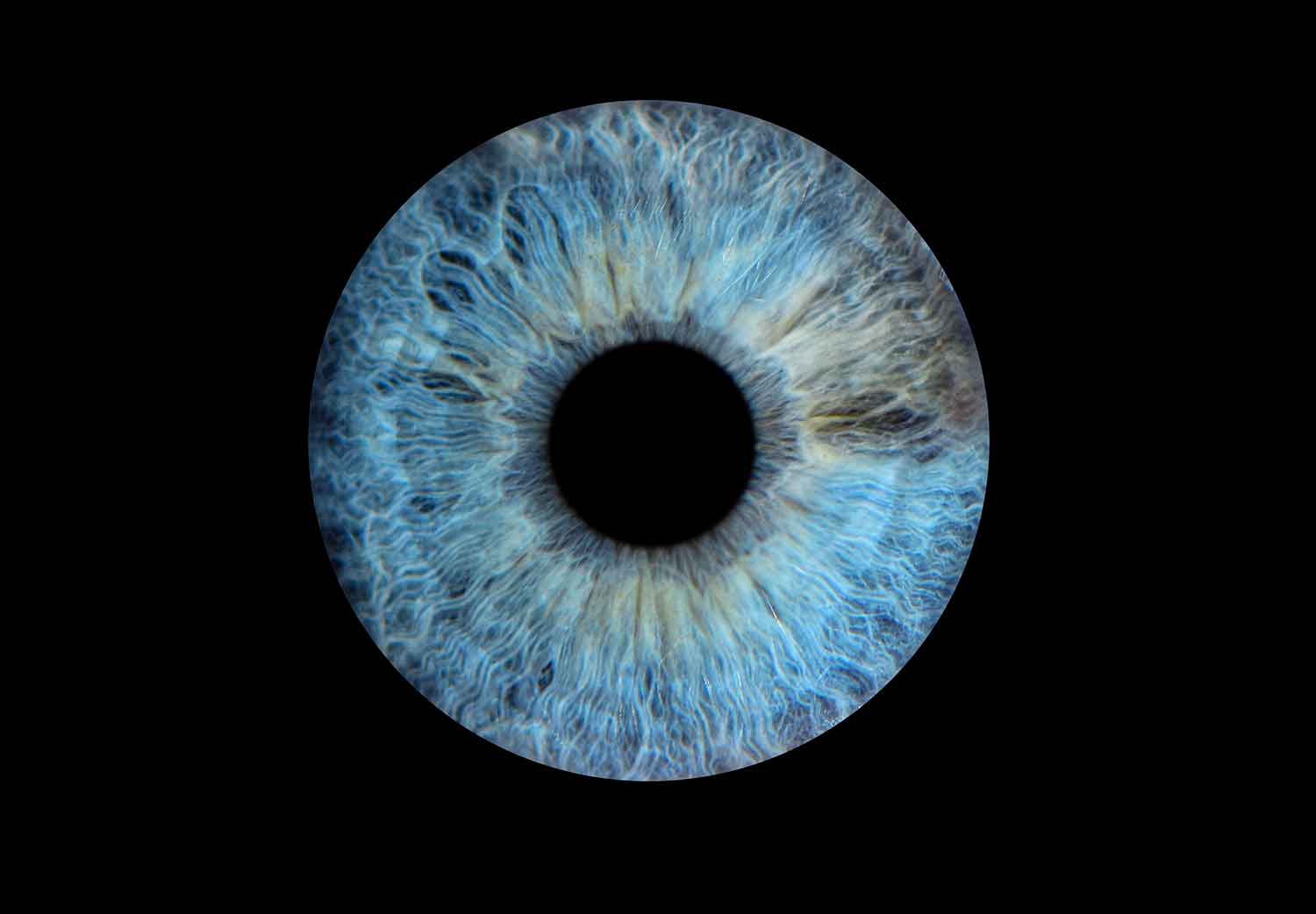 accidentes en los ojos