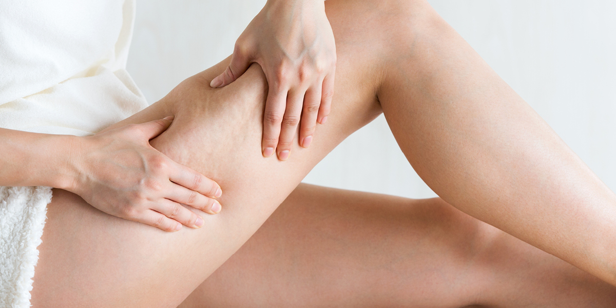 radiesse en el cuerpo