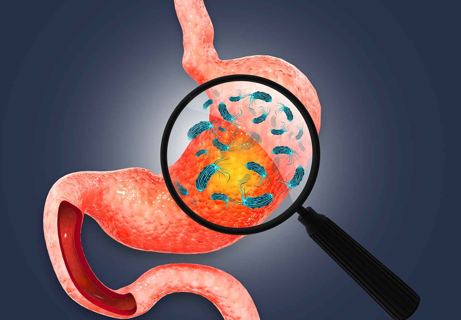 FilmArray-o-PCR-Multiple