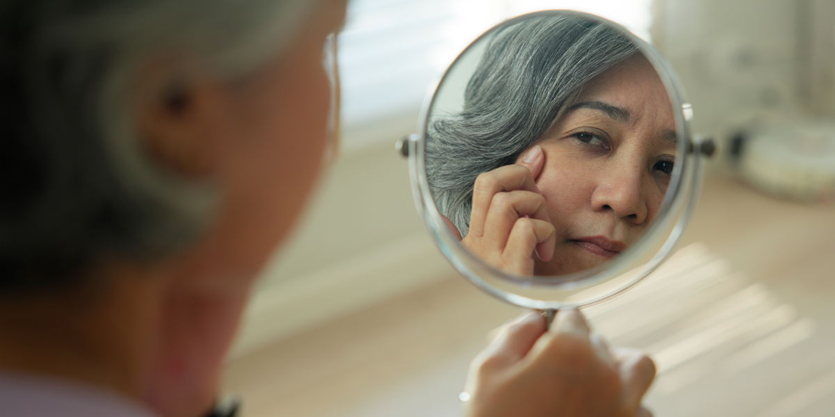 Radiesse en menopausia